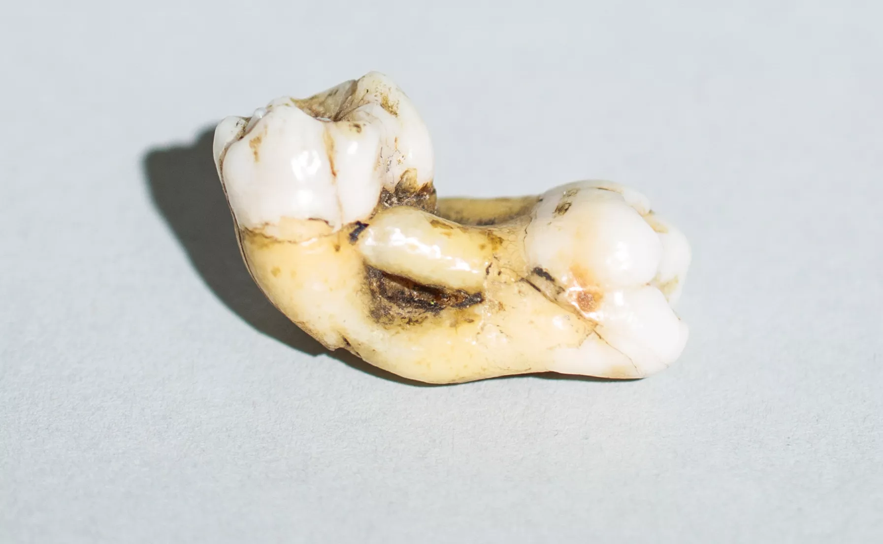 Teeth for Two Incisal Edge Strategies to Accelerate Success