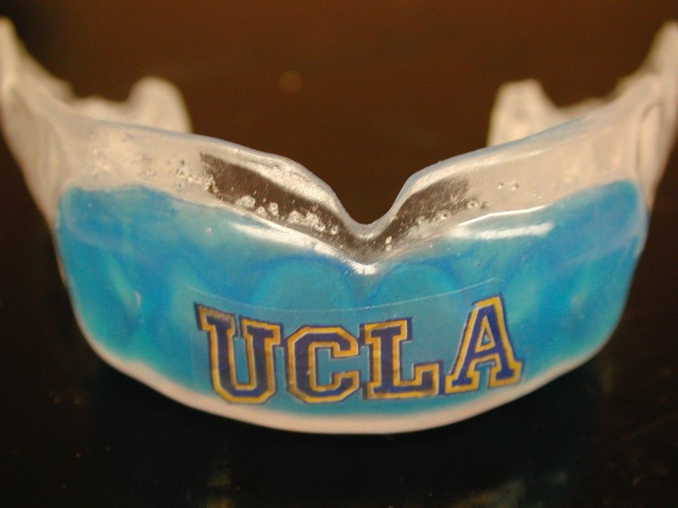 Dr-Ray-Padilla-UCLA-customized-mouthguard- Los-Angeles-sports-dentistry